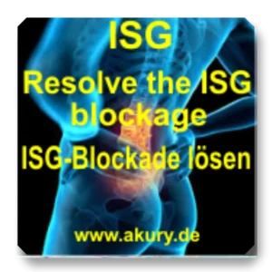 ISG